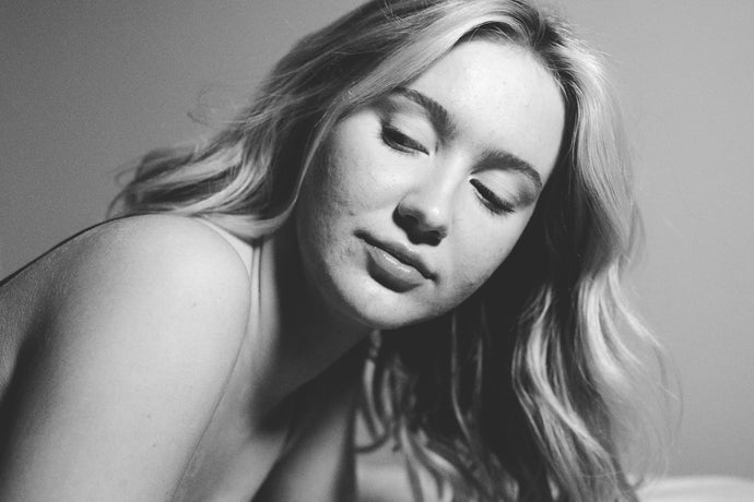 Derfor er bumser ikke (nødvendigvis) et tegn på fedtet hud