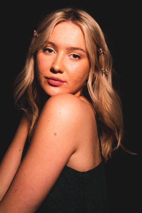 Hvad fortæller din akne dig om dit helbred?